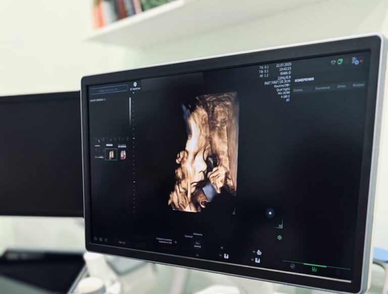 Точность в деталях: «УльтраМед» внедрил экспертный формат отчетов в области пренатальной ультразвуковой диагностике